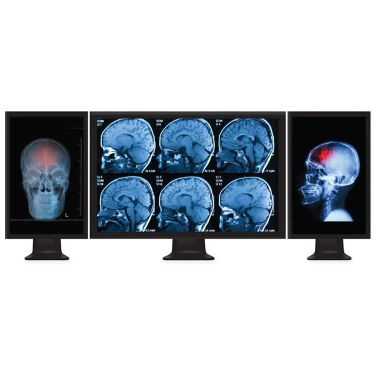 Multi Stream Transport Hub DisplayPort 3 Ports Schwarz