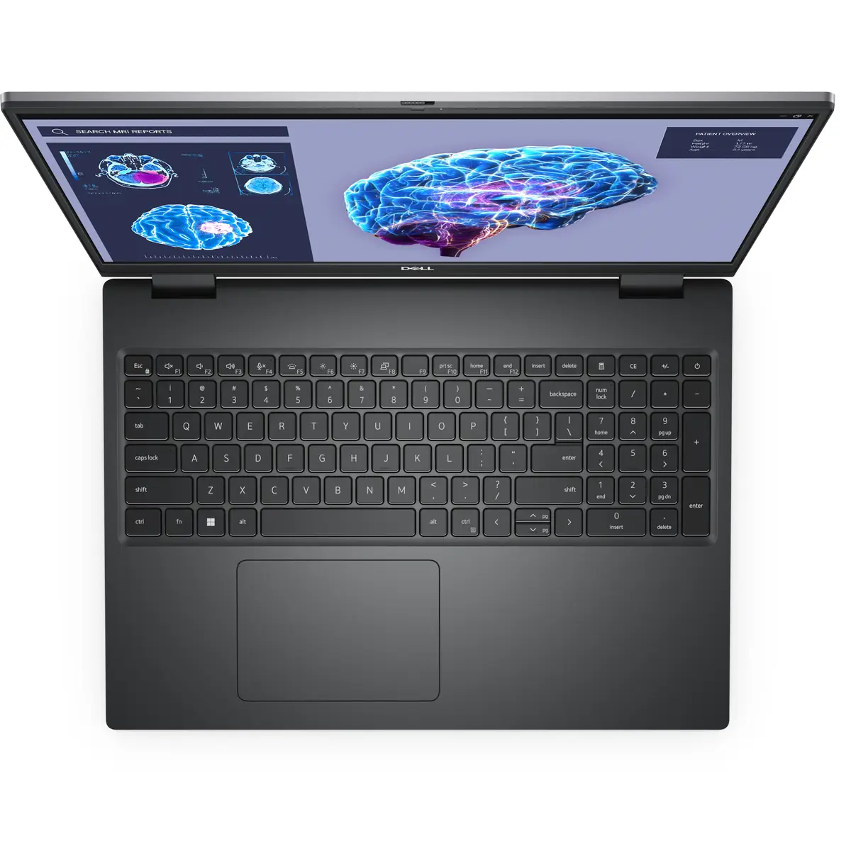 Precision 7680 i9-13950HX 32GB DDR5 1TB 40,6cm W11P