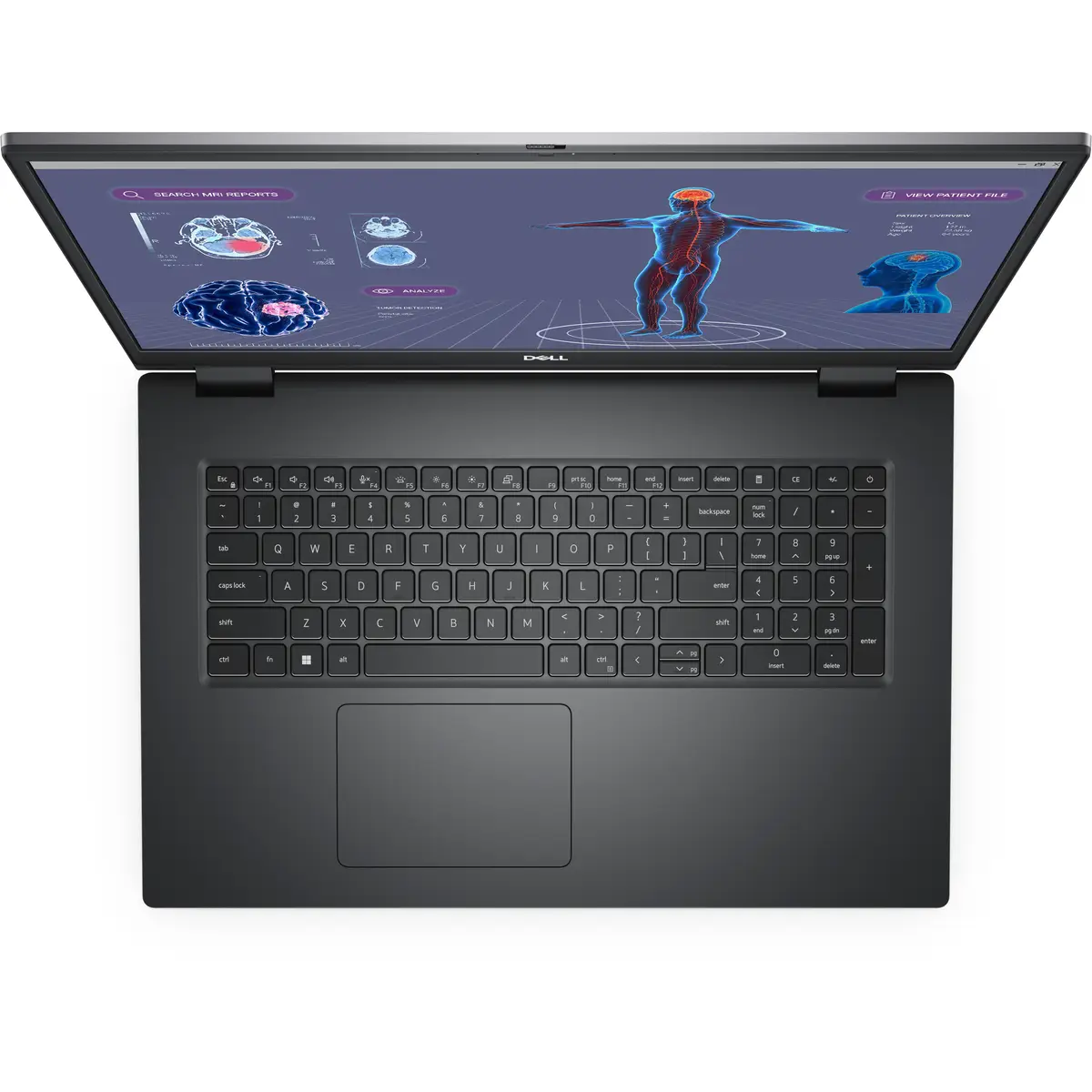 Precision 7780 i7-13850HX 32GB DDR5 1TB 43,9cm Win11P